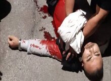 حمله اراذل و اوباش به مامور آتش‌نشانی در بوستان سرخه حصار+ عکس