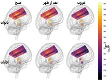مغز زنان داغ تر از مردان است!/ یک کشف جالب در نقشه۴ بعدی دمای مغز(+عکس)