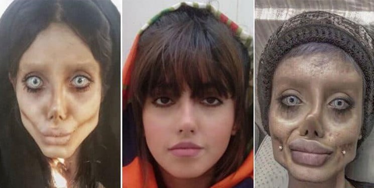 وکیل سحر تبر: موکلم دچار بیماری روانی است جایش در زندان نیست