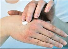 علت خشکی پوست در پاییز چیست؟/ ۶ نکته برای رفع خشکی پوست