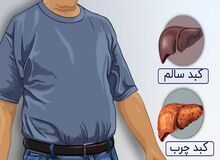 کبد چرب را با این روش به‌راحتی درمان کنید