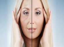 هایفوتراپی بهتر است یا اندولیفت؟ (مقایسه ماندگاری، درد و عوارض)