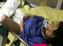 جزئیات تکان دهنده جدید از حادثه کودک آزاری در مهاباد/ والدین معتاد؛ متهمان اصلی/ شکنجه 2 ماهه دلیل وحشت کودک از اطرافیان+ عکس