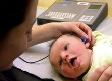 احتمال آسیب به شنوایی نوزادانی که در بخش NICU بیمارستان بستری می‌شوند
