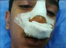 از ضرب و شتم و تهدید دانش‌آموز تا برکناری مدیر
