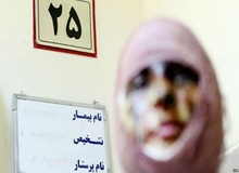 طرح «تشدید مجازات اسیدپاشی» در کمیسیون قضایی تصویب شد
