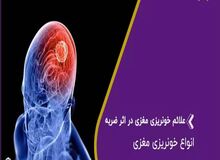 علائم خونریزی مغزی چیست؟