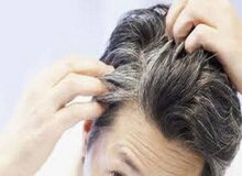 شناسایی ۶ وضعیت پزشکی از ظاهر موی سر
