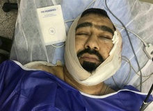 حمله خونین به یک طلبه در شرق تهران/ ضارب: شیطان به من الهام کرد