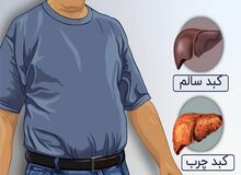این کارها از چرب شدن کبد جلوگیری می‌کند/ ۲ نشانه مهم کبد چرب