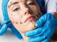 بحران عظیم ژل فله‌ای تقلبی روی صورت مردم/ اکثر مطب‌ها و کلینیک‌های زیبایی غیرمجاز هستند