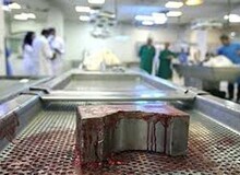 تایید، تکذیب، کتمان/ عضو کمیسیون بهداشت : در جلسه  فردای کمیسیون مسئله فروش «جسد توسط مافیا» را مطرح می کنیم / رئیس سازمان پزشکی قانونی: جسد فروشی نداریم 
