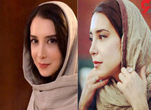 توضیح سازمان نظام پزشکی درباره فلج شدن فک سحر جعفری جوزانی بازیگر سینما: پوزش می‌خواهیم/ اگر درمان نشدید شکایت کنید