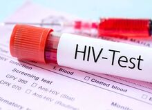 پیشرفت مهم در مسیر درمان «HIV» که پژوهشگران را شگفت‌زده کرد