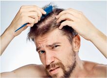 آیا رژیم لاغری باعث ریزش مو می شود؟ روش های جلوگیری از ریزش مو در رژیم