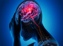 دومین عامل مرگ و میر در کشور/ زمان طلایی درمان