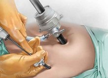 جزییات مرگ دانشجوی رشته مهندسی در اتاق عمل/ زن ۱۴۰ کیلویی چطور جان باخت؟
