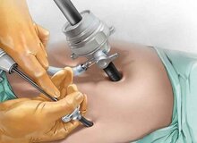 جزییات مرگ دانشجوی رشته مهندسی در اتاق عمل/ زن ۱۴۰ کیلویی چطور جان باخت؟
