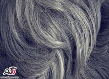 کمبود چه ماده ی غذایی در بدن باعث سفید شدن موها میشود؟