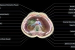 اسکن بدن بدون نیاز به دستگاه MRI / پروژه بلندپروازانه «میدجرنی مدیکال»