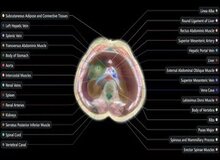 اسکن بدن بدون نیاز به دستگاه MRI / پروژه بلندپروازانه «میدجرنی مدیکال»