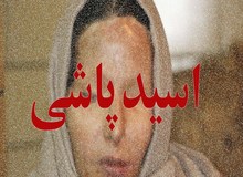 نوروزی: با مصوبه کمیسیون قضایی مرتکب اسیدپاشی مفسد فی‌الارض قلمداد می‌شود
