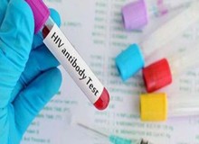 واکسن HPV ایرانی به مرحله پایانی تولید رسید/ مرگ سالانه ۳۷۰ زن مبتلا به سرطان دهانه رحم در ایران
