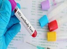 واکسن HPV ایرانی به مرحله پایانی تولید رسید/ مرگ سالانه ۳۷۰ زن مبتلا به سرطان دهانه رحم در ایران
