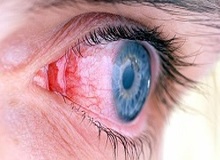 مصرف سیگار به بینایی چشم آسیب می زند + بیشتر بدانید