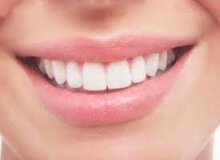 با ۵ راه طبیعی برای سفید کردن دندان‌ها آشنا شوید 