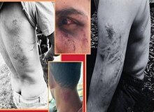 در اوپرت چه گذشت؟/ حمله بسیج با شوکر و باتوم به گردشگران 