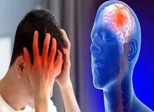  علائم تومور مغزی چیست؟/ با مشاهده این علائم حتما به پزشک مراجعه کنید