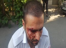 اورژانس تهران: یک نیروی ما توسط یک پسر جوان مجروح شد / پسر جوان از محل متواری شد 