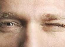 
علت رایج پرش چشم چیست؟
