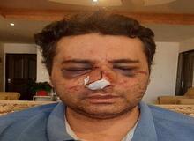 ضرب و شتم شدید یک متخصص بیهوشی توسط همراهان یک بیمار در پیرانشهر+تصاویر 