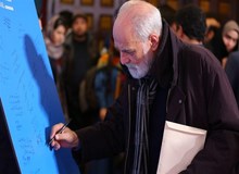 آیدین آغداشلو در بیمارستان آبان تحت عمل جراحی قرار گرفت