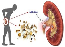 چه داروهایی برای کلیه پر خطر هستند